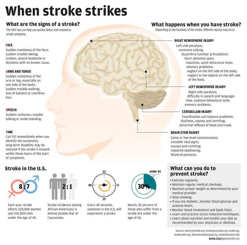 When Stroke Strikes infographic showing symptoms and prevention